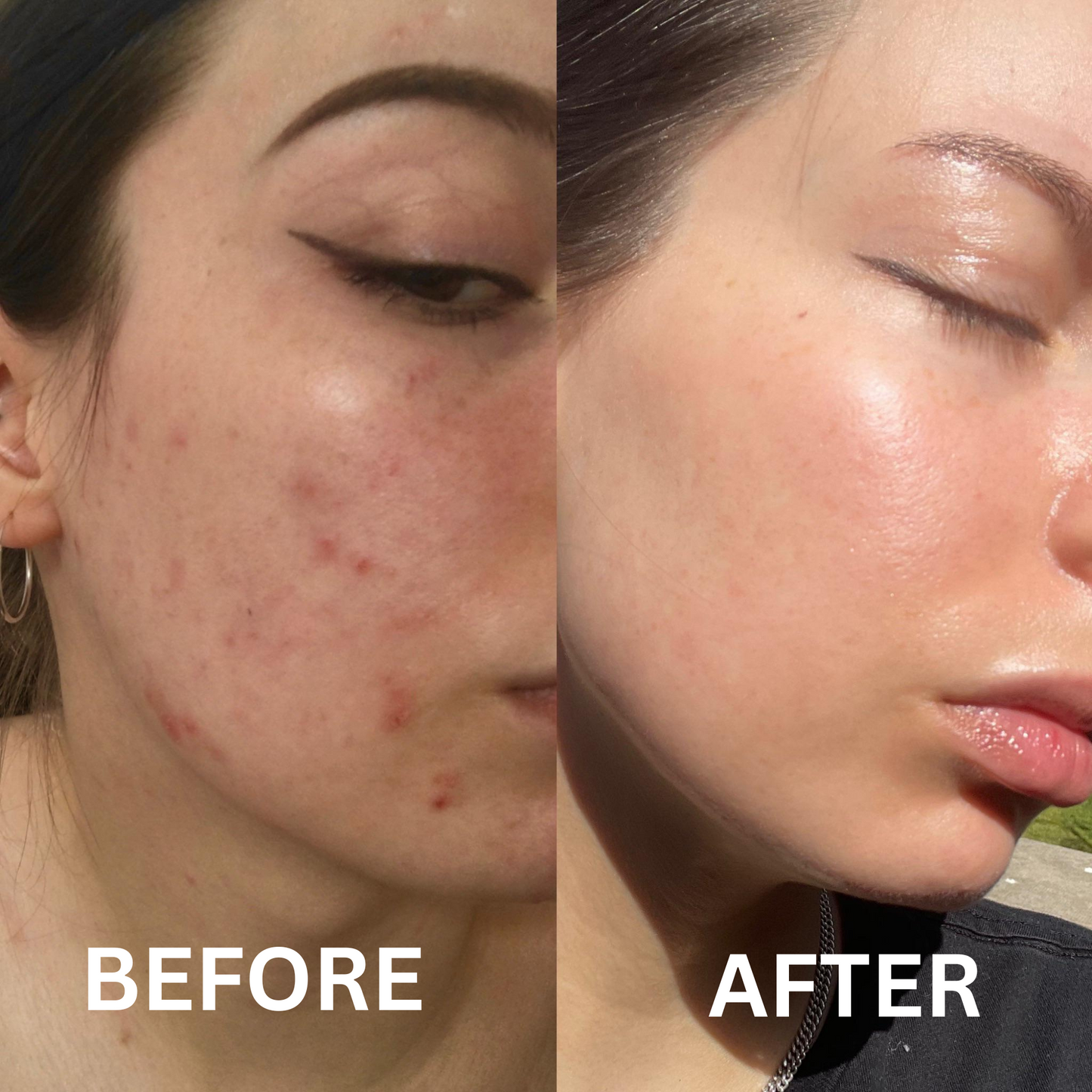 RetinolGlow Vitamin A Renewal Cream