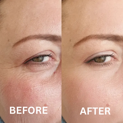 RetinolGlow Vitamin A Renewal Cream